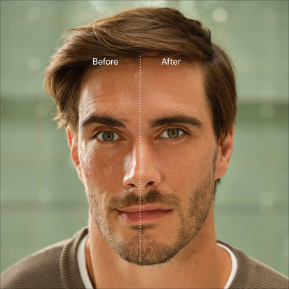 Anti-Shine - Single